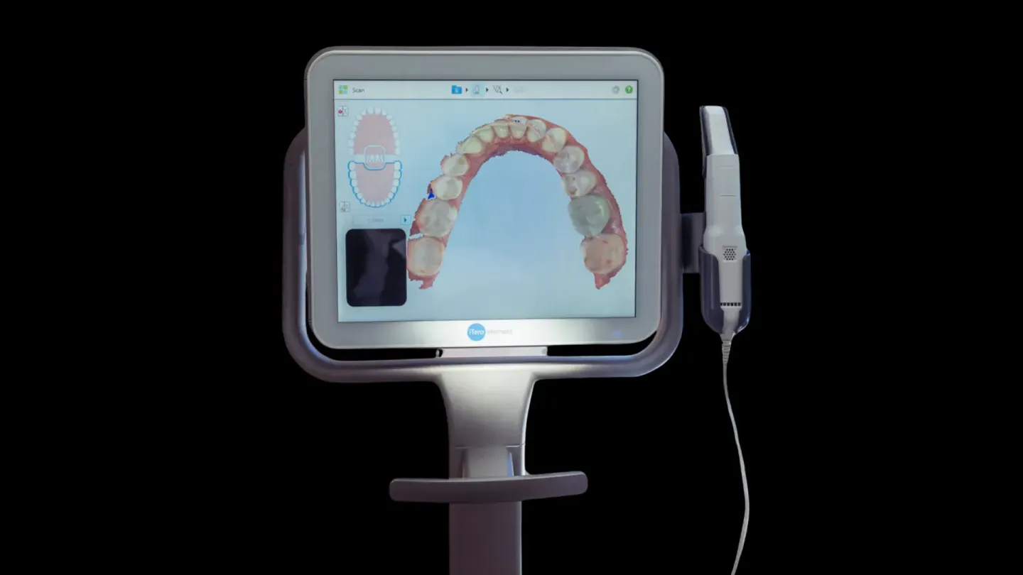 Precise digital impressions of your teeth and bite, allowing for accurate, comfortable, and efficient treatment planning.