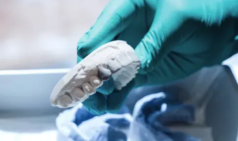 Full Mouth Rehabilitation